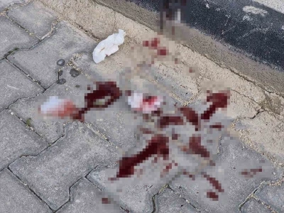 16 yaşındaki &ccedil;ocuk caddede bacağından bı&ccedil;aklandı
