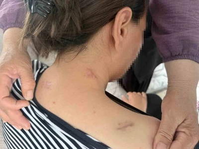 17 bı&ccedil;ak darbesi aldı, &ouml;l&uuml; numarasıyla kurtuldu, kocasının en ağır cezayı almasını istedi
