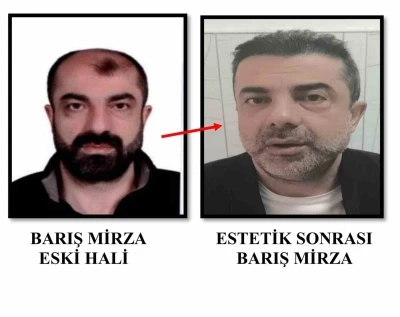 Ameliyat ile y&uuml;z&uuml;n&uuml; değiştiren firari cinayet zanlısı, 7 yıl sonra yakalandı
