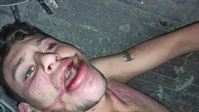 Antalya'da hamam böceği yedirilen gencin dosyasında karar verildi