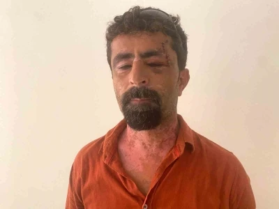 Antalya’da öfkeli damat kayınpederini hastanelik etti
