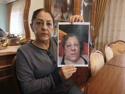 Apartman bahçesinde beslediği kediler nedeniyle komşuları tarafından darbedilen kadının burnu kırıldı
