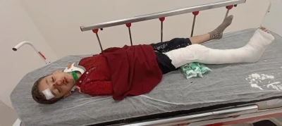 Başakşehir’de 8 yaşındaki çocuğa trafiğe kapalı alanda motosiklet çarptı: Baba yardım istedi
