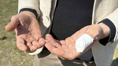 Başıboş pitbull, vatandaş ile k&ouml;peğine dehşeti yaşattı
