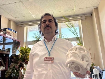 Beyin t&uuml;m&ouml;r&uuml; ameliyatı sonrası &ccedil;&ouml;ken alnı, 3 boyutlu implantla d&uuml;zeltildi
