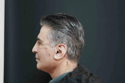 Bitlis&rsquo;te ilk defa y&uuml;z germe ameliyatı başarıyla yapıldı
