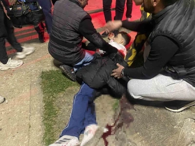 Bursa&rsquo;da parkta bı&ccedil;aklı kavga: 16 yaşındaki &ccedil;ocuk yaralandı
