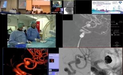 Canlı yayında zorlu beyin ameliyatı
