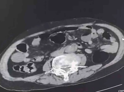 Cinsel organında Denizli’ye uyuşturucu sokmak isteyen yabancı uyruklu şahıs tutuklandı
