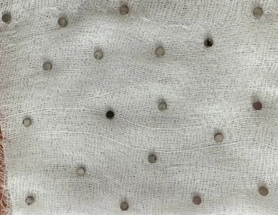 Çocuğun boğazından 19 adet mıknatıs çıkartıldı
