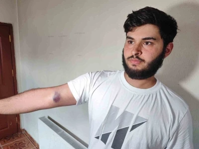 Conolar hem topu vermedi hem de aileye sopalı silahlı saldırıda bulundu
