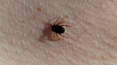 Doğu Karadeniz&rsquo;de kene sezonu sakin ge&ccedil;iyor
