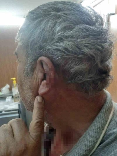 Doktor ile emekli öğretmenin mesai kavgası karakolda bitti
