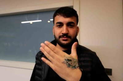 D&ouml;vme sildirmek isterken kabusu yaşadı, elindeki dokular &ouml;ld&uuml;
