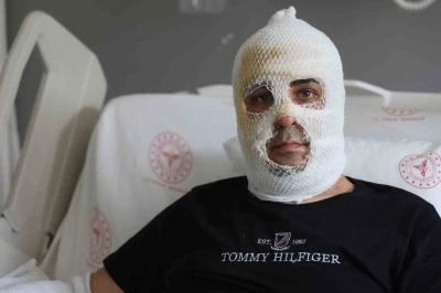 Ekmek teknesi k&uuml;le d&ouml;nmesin diye m&uuml;cadele eden esnafın y&uuml;z&uuml; ve v&uuml;cudu yaşanan patlamayla yandı
