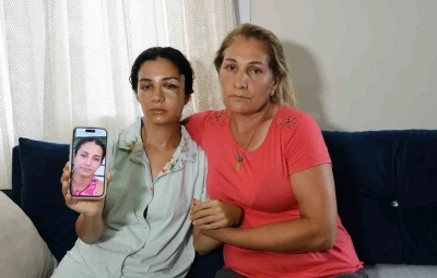 Eski eşinden şiddet gören kadın: &quot;Ben yaşarken kurtulayım, öldükten sonra değil&quot;
