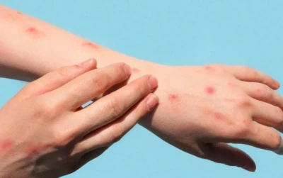 Gaziantepli Anneler babalar uzmanlara kulak verin