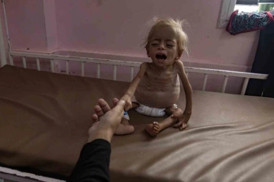 Gazze’de 8 sivil daha açlık nedeniyle hayatını kaybetti
