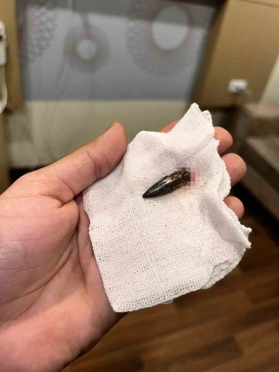 Gazzeli Awad, 1,5 yıldır kafasında taşıdığı mermiden T&uuml;rk yardımseverlerin desteğiyle kurtuldu
