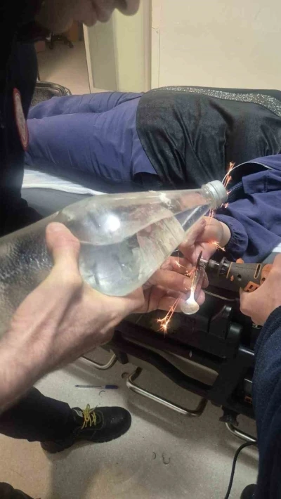 G&ouml;nen&rsquo;de parmağa sıkışan y&uuml;z&uuml;k itfaiye tarafından kesildi

