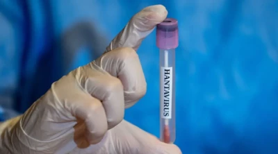 Hantavir&uuml;s Alarmı! Uzmanlar &ldquo;Panik Yerine Tedbir&rdquo; &Ccedil;ağrısı Yaptı
