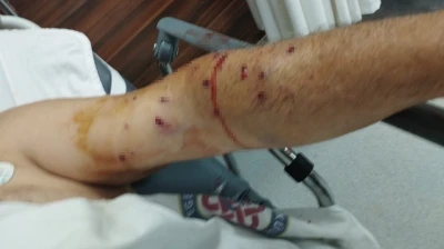 İzmir’de tır sahibi 180 liralık kantar ücreti için çalışanı vurdu
