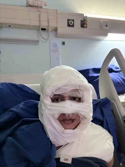 Kadıköy’de akıl almaz olay: Genç kadın başka bir kadın tarafından ateşe verildi
