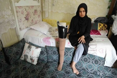 Kahramanmaraş merkezli büyük depremde bacağını kaybetti, eşi terk etti
