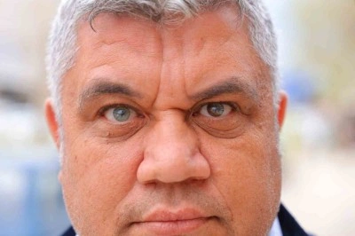 Kahramanmaraşlı adam 3 renkli g&ouml;zleriyle g&ouml;renlerin ilgisini &ccedil;ekiyor