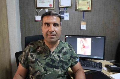 KBB Uzmanı Özer: &quot;Kulaklarımız ıslak ve nemli kalınca yüzücü kulak hastalığı oluşuyor&quot;
