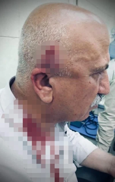 Kerk&uuml;k&rsquo;te ka&ccedil;ak yapı yıkımı sırasında kaymakama bı&ccedil;aklı ve sopalı saldırı
