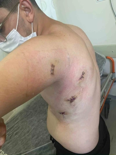 Kız kardeşini korumak isterken 5 yerinden bıçaklanmıştı: O anları anlattı: &quot;Ölümden döndüm&quot;
