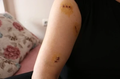 Kocası tarafından 30 yerinden bı&ccedil;aklandı, g&ouml;r&uuml;mcesi şikayetini geri &ccedil;ekmesini istedi
