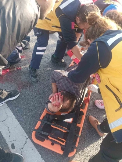 Köpeğe çarpmamak için manevra yapınca bariyerlere çarpıp yaralandı
