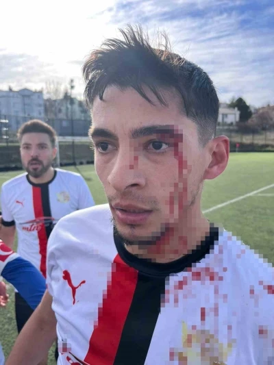 Ma&ccedil; sonrası saha i&ccedil;i savaş alanına d&ouml;nd&uuml;, 3 futbolcu hastanelik oldu

