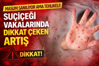 Masum Sanılıyor Ama Tehlikeli! Su&ccedil;i&ccedil;eği Vakalarında Dikkat &Ccedil;eken Artış