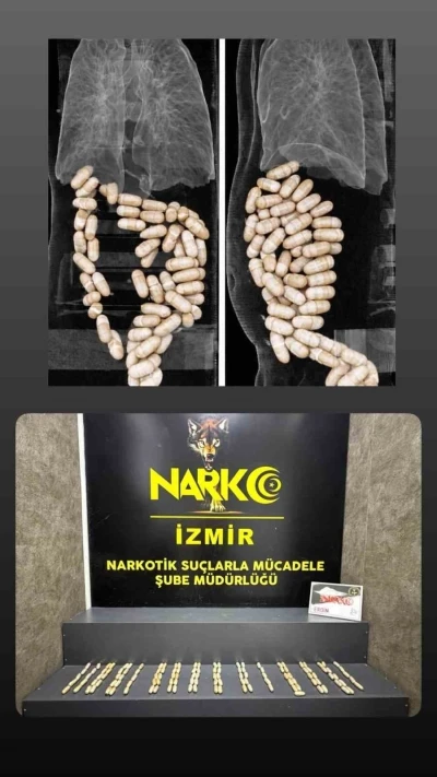 Midesinde uyuşturucu taşıyan ş&uuml;pheliler tutuklandı
