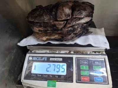 Nefes darlığı şikayeti ile hastaneye gitti, göğsünden 3 kilogramlık tümör çıktı
