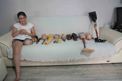 Okulların açılmasına günler kala 12 yaşındaki Özge’ye dar gelen protez bacak engeli
