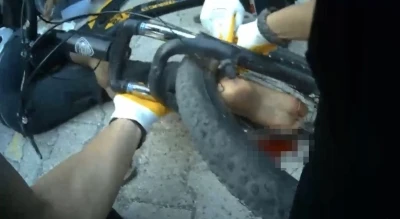 Osmaniye&rsquo;de ayağı bisikletin tekerine sıkışan &ccedil;ocuk ekiplerce kurtarıldı
