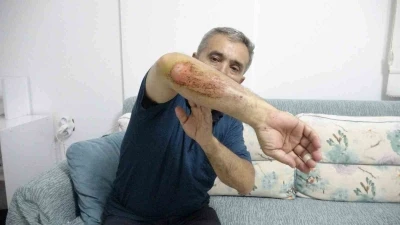 Otizmli oğluyla doğa gezisi sırasında sahipli k&ouml;peklerin saldırısına uğradı
