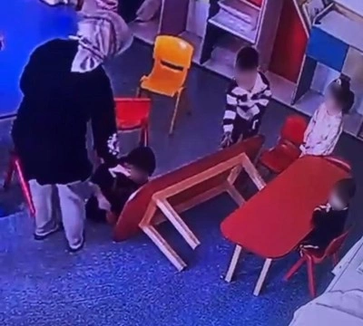 &Ouml;zel okulda skandal g&ouml;r&uuml;nt&uuml; kameraya yansıdı: &Ccedil;ocuğun parmakları bu hale geldi