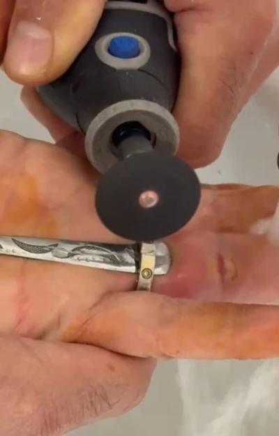 Parmağına yüzük sıkışan kadının yardımına itfaiye yetişti
