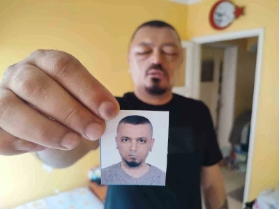 Saçlarını siyahlatmak için aldığı şampuan arı sokmasından beter hale getirdi
