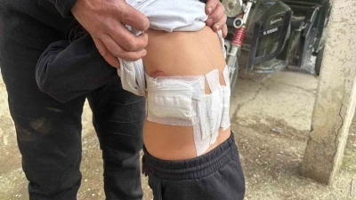 Saldırgan eşek evinin &ouml;n&uuml;nde oynayan 5 yaşındaki &ccedil;ocuğa kabusu yaşattı
