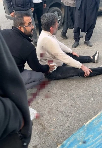 Şanlıurfa’da bıçaklı kavga: 1 yaralı
