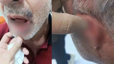 Şehitkamil Devlet Hastanesi&rsquo;nde Sağlık &Ccedil;alışanına &Ccedil;irkin Saldırı