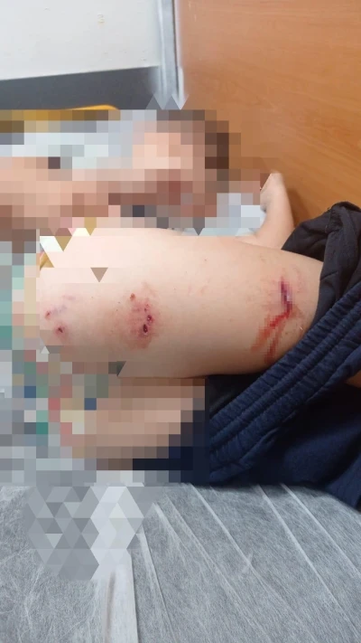 Sokak köpekleri faciaya neden oluyordu: Komşular yetişmeseydi parçalayacaklardı
