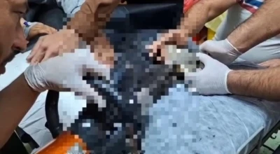 Tel Abyad’ta elini kıyma makinesine kaptıran çocuk Şanlıurfa’da tedavi altına alındı
