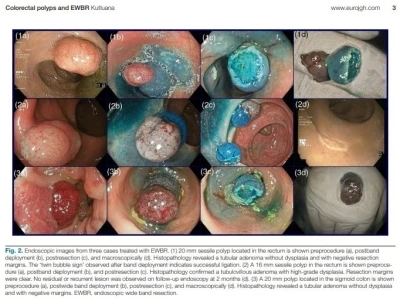 Türk bilim adamının yeni yöntemi uluslararası tıp camiasında kabul gördü
